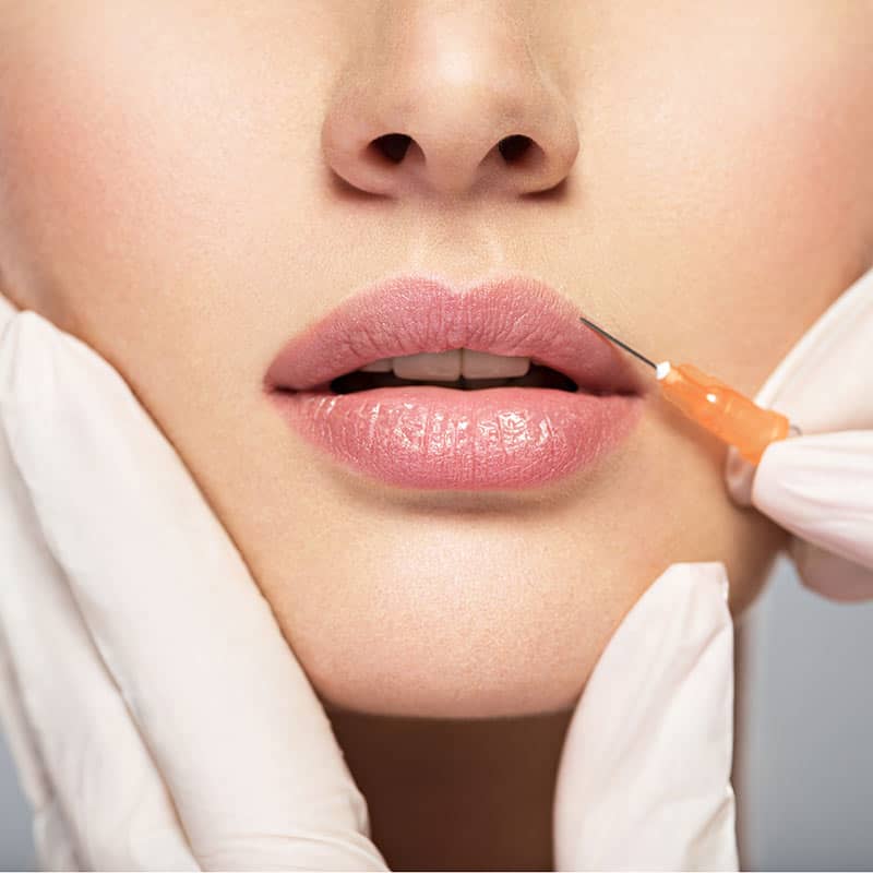 Lips | Fine Line Aesthetics In Frisco, TX
