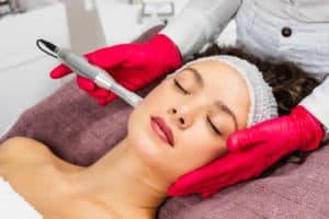 What Are The Benefits To Microneedling