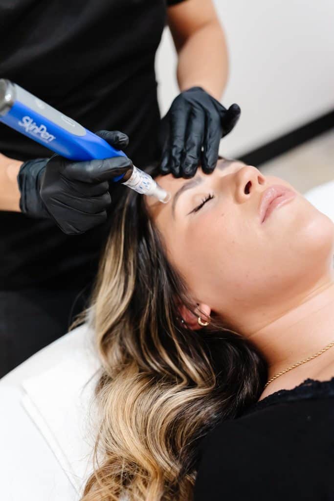 The Science Behind Microneedling 2 Microneedling