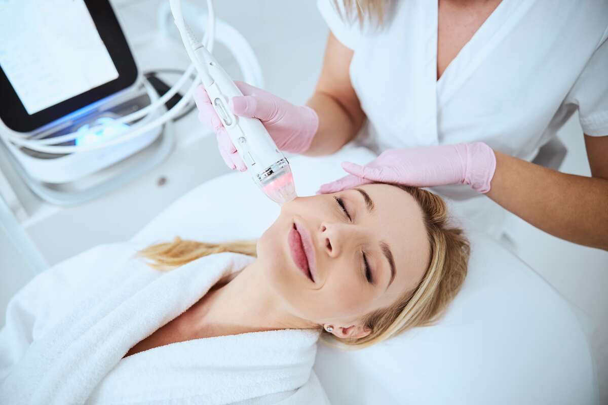 RF Microneedling by Fine Line Aesthetics in Frisco TX