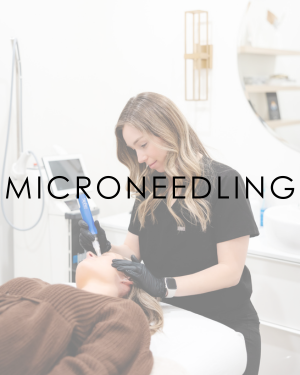 Microneedling in Frisco TX