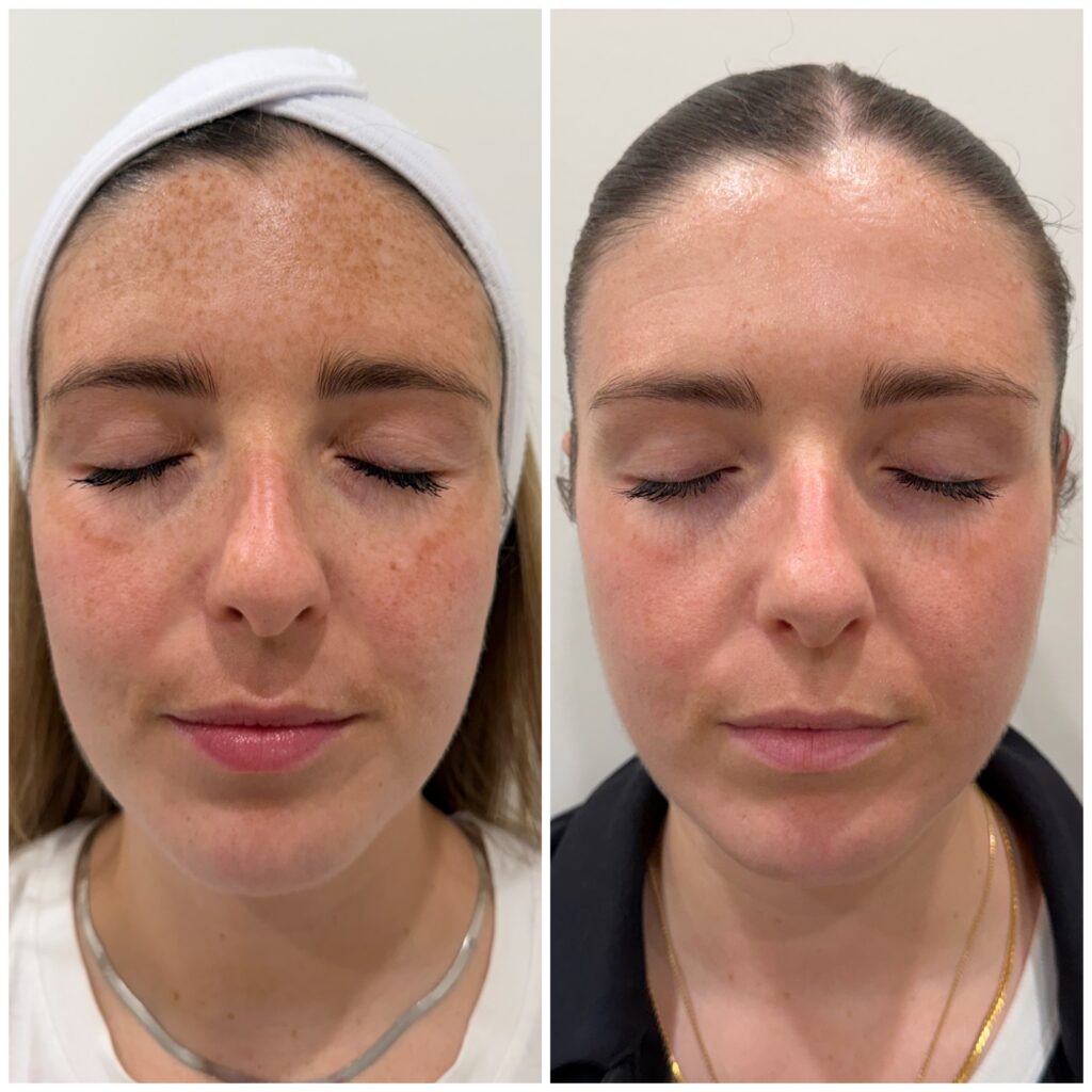 Moxi BBL Ashley Front