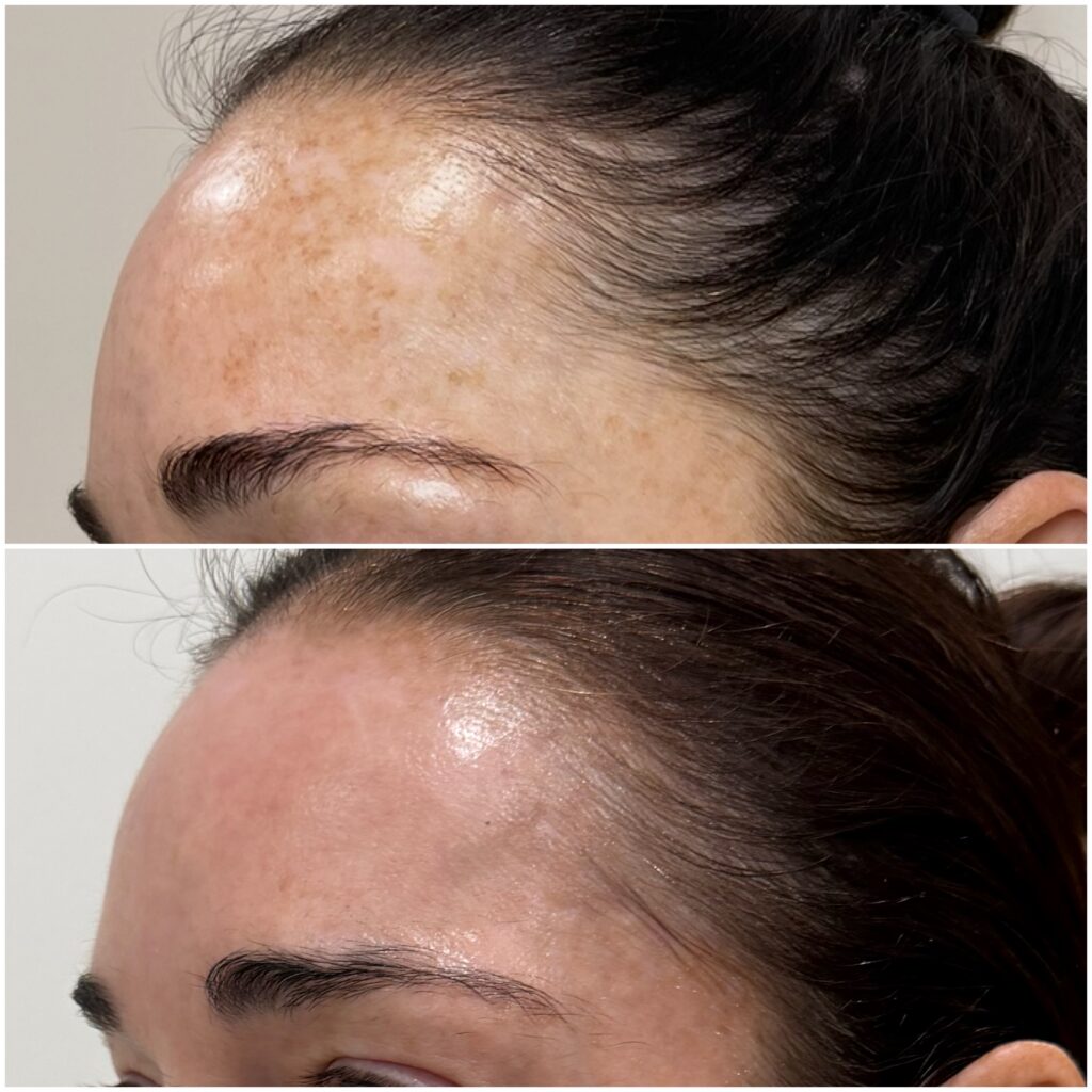 Moxi BBL Ashley close up